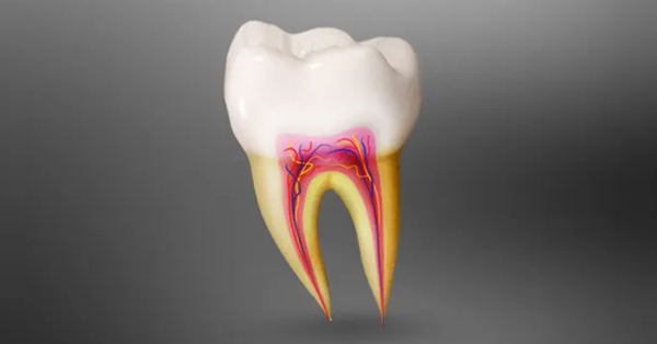 Root Canal vs. Extraction in Grand Prairie: Which is Best?